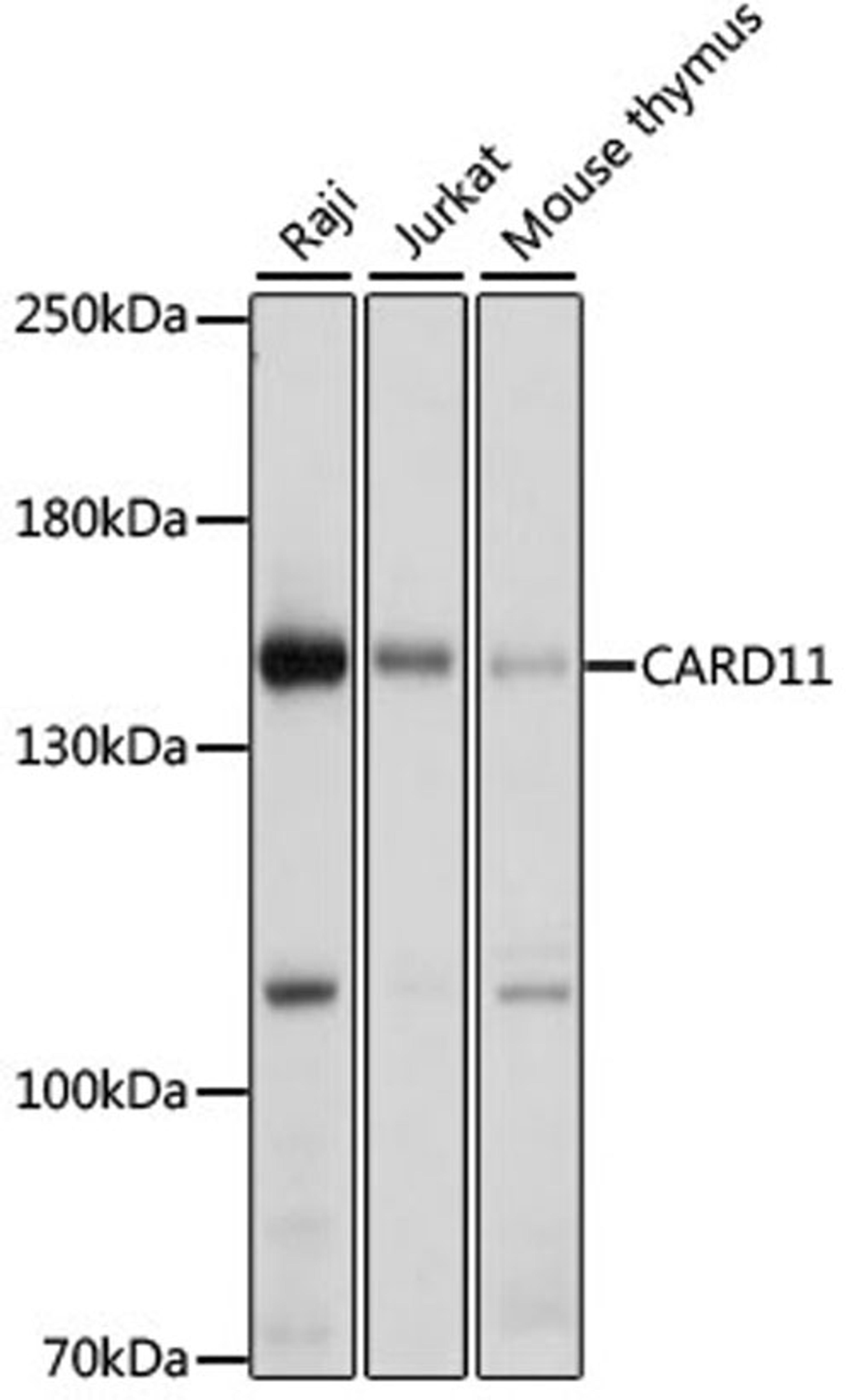 Western blot - CARD11 antibody (A7140)