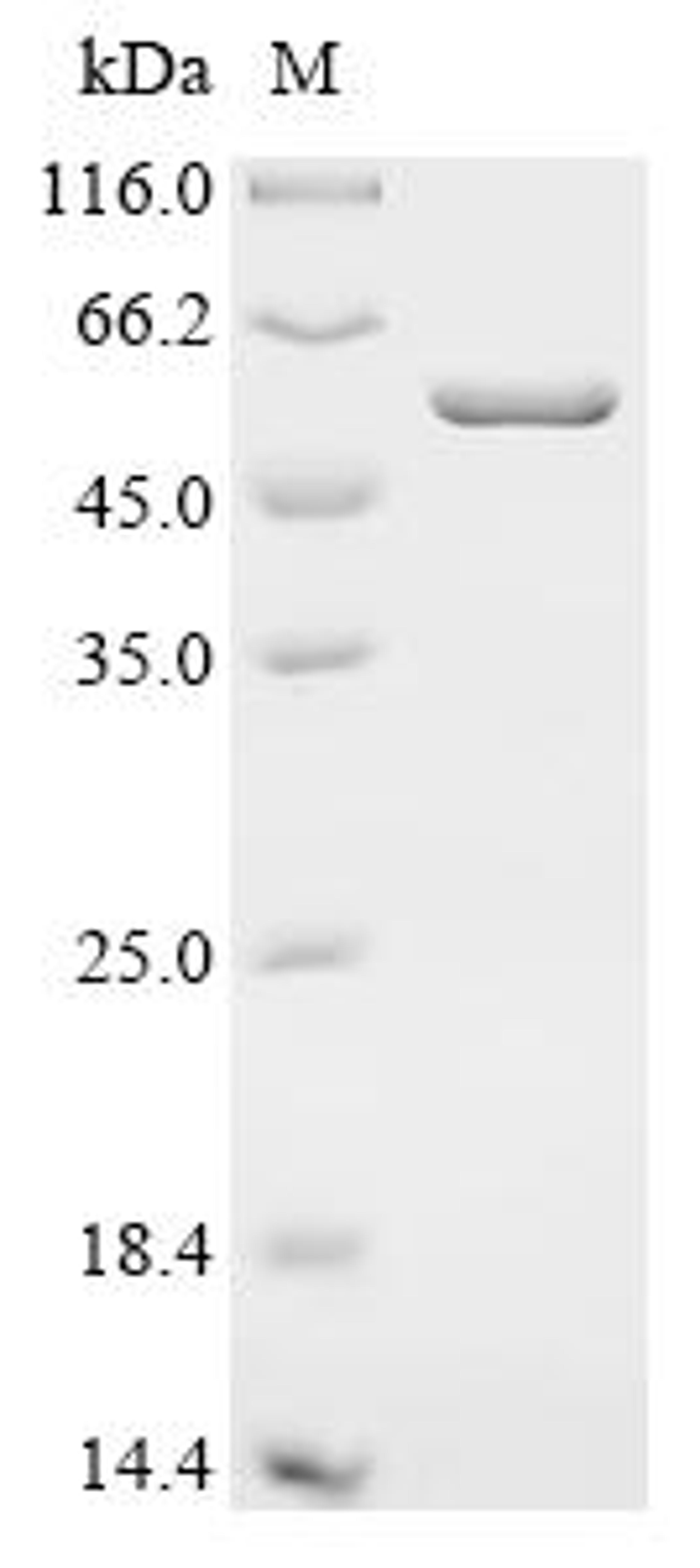 (Tris-Glycine gel) Discontinuous SDS-PAGE (reduced) with 5% enrichment gel and 15% separation gel.