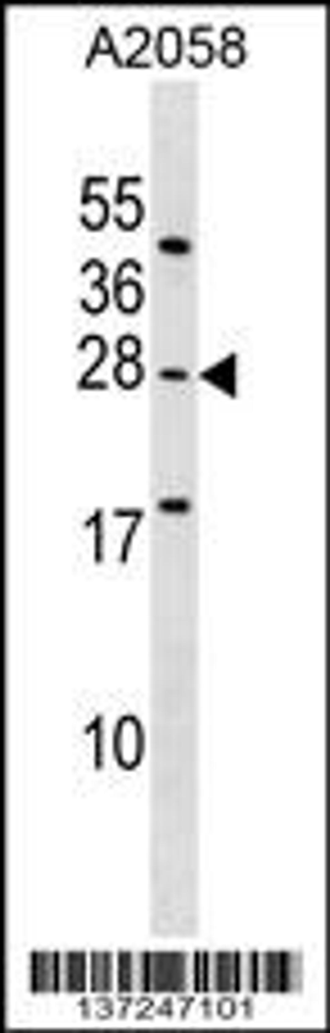 Western blot analysis in A2058 cell line lysates (35ug/lane).