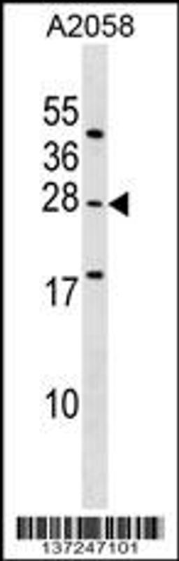 Western blot analysis in A2058 cell line lysates (35ug/lane).