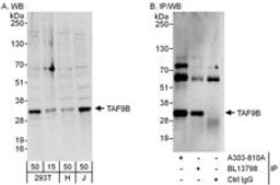 Detection of human TAF9B by western blot and immunoprecipitation.