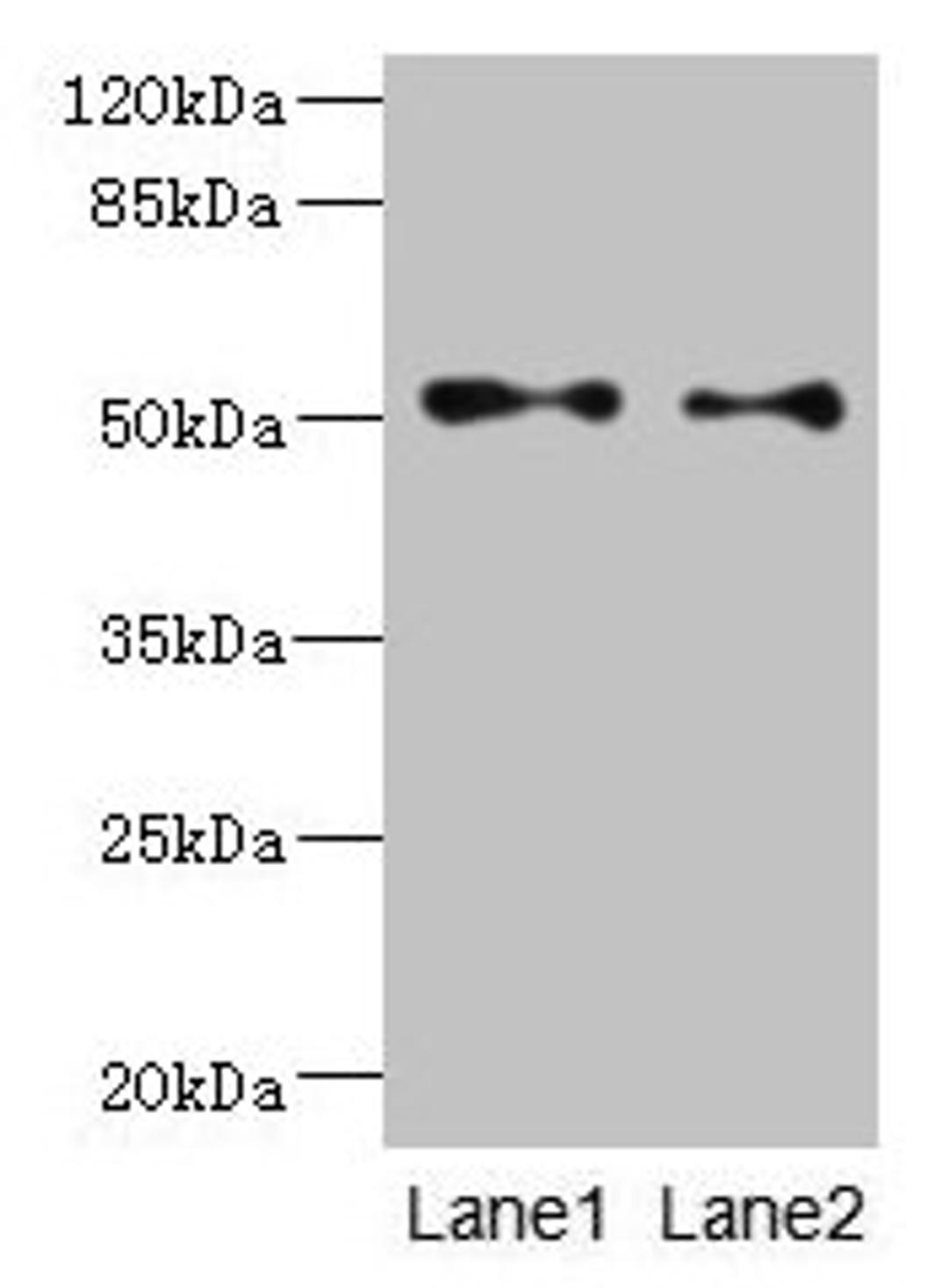 Western blot. All lanes: TUBB3 antibody at 6µg/ml. Lane 1: A549 whole cell lysate. Lane 2: A431 whole cell lysate. Secondary. Goat polyclonal to rabbit IgG at 1/10000 dilution. Predicted band size: 51, 43 kDa. Observed band size: 51 kDa