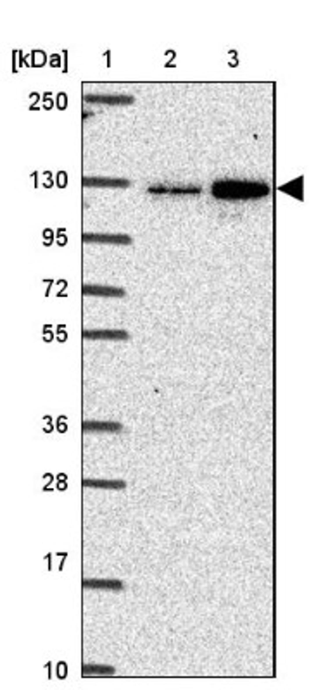 Western Blot: CGNL1 Antibody [NBP2-37959] - Lane 1: Marker [kDa] 250, 130, 95, 72, 55, 36, 28, 17, 10<br/>Lane 2: RT-4<br/>Lane 3: U-251 MG