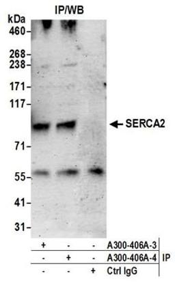 Detection of human SERCA2 by western blot of immunoprecipitates.