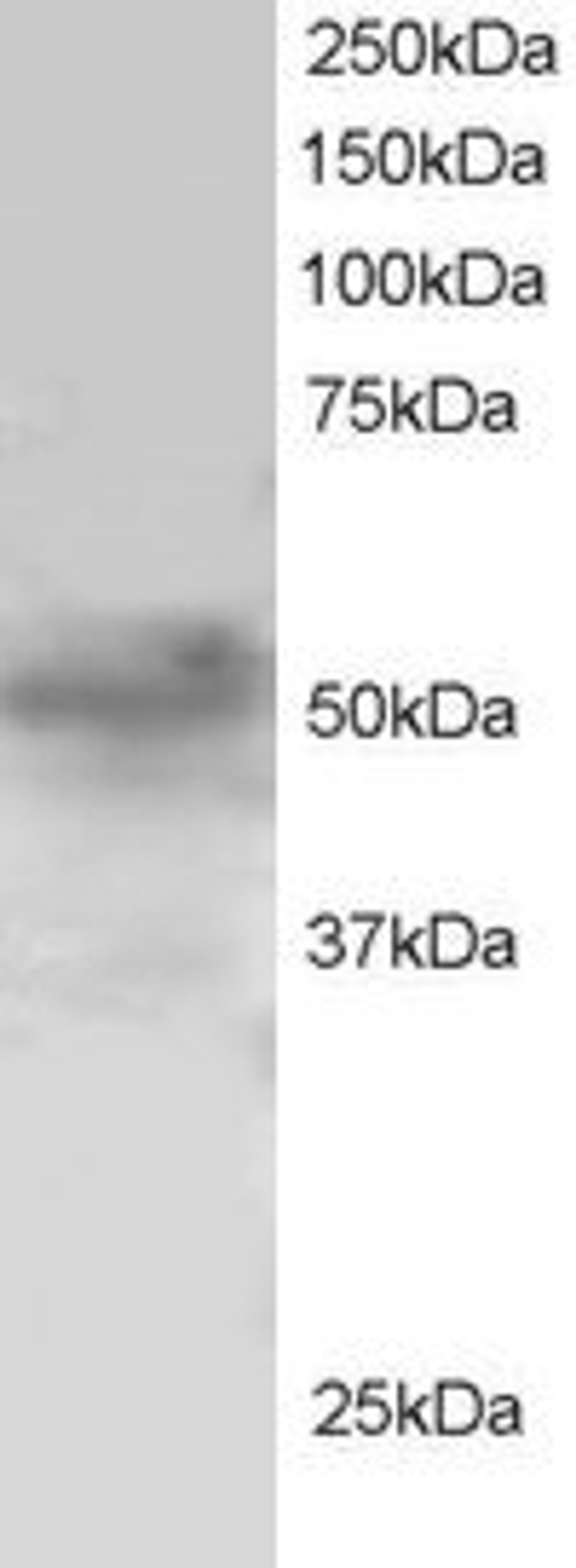 45-628 staining (1ug/ml) of H460 lysate (RIPA buffer, 30ug total protein per lane). Primary incubated for 1 hour. Detected by chemiluminescence.