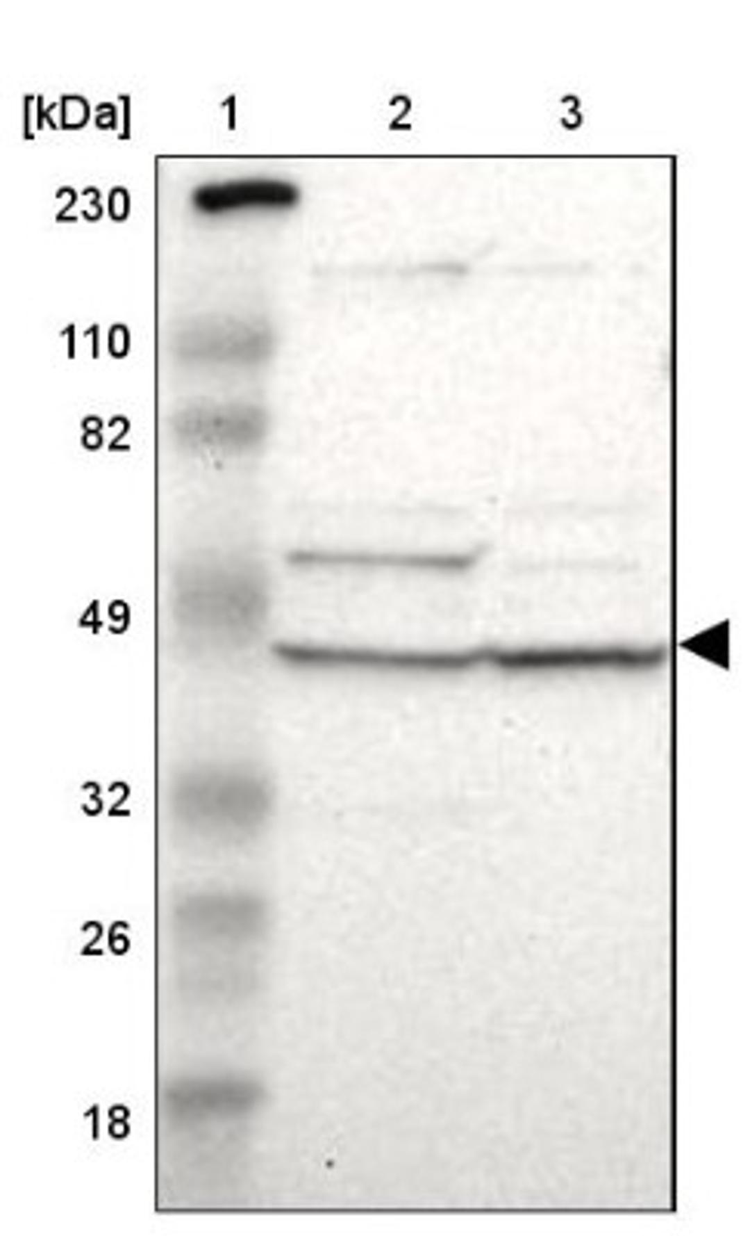 Western Blot: VSIG4 Antibody [NBP1-86843] - Lane 1: Marker [kDa] 230, 110, 82, 49, 32, 26, 18<br/>Lane 2: Human cell line RT-4<br/>Lane 3: Human cell line U-251MG sp