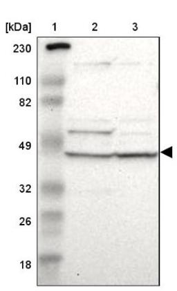 Western Blot: VSIG4 Antibody [NBP1-86843] - Lane 1: Marker [kDa] 230, 110, 82, 49, 32, 26, 18<br/>Lane 2: Human cell line RT-4<br/>Lane 3: Human cell line U-251MG sp