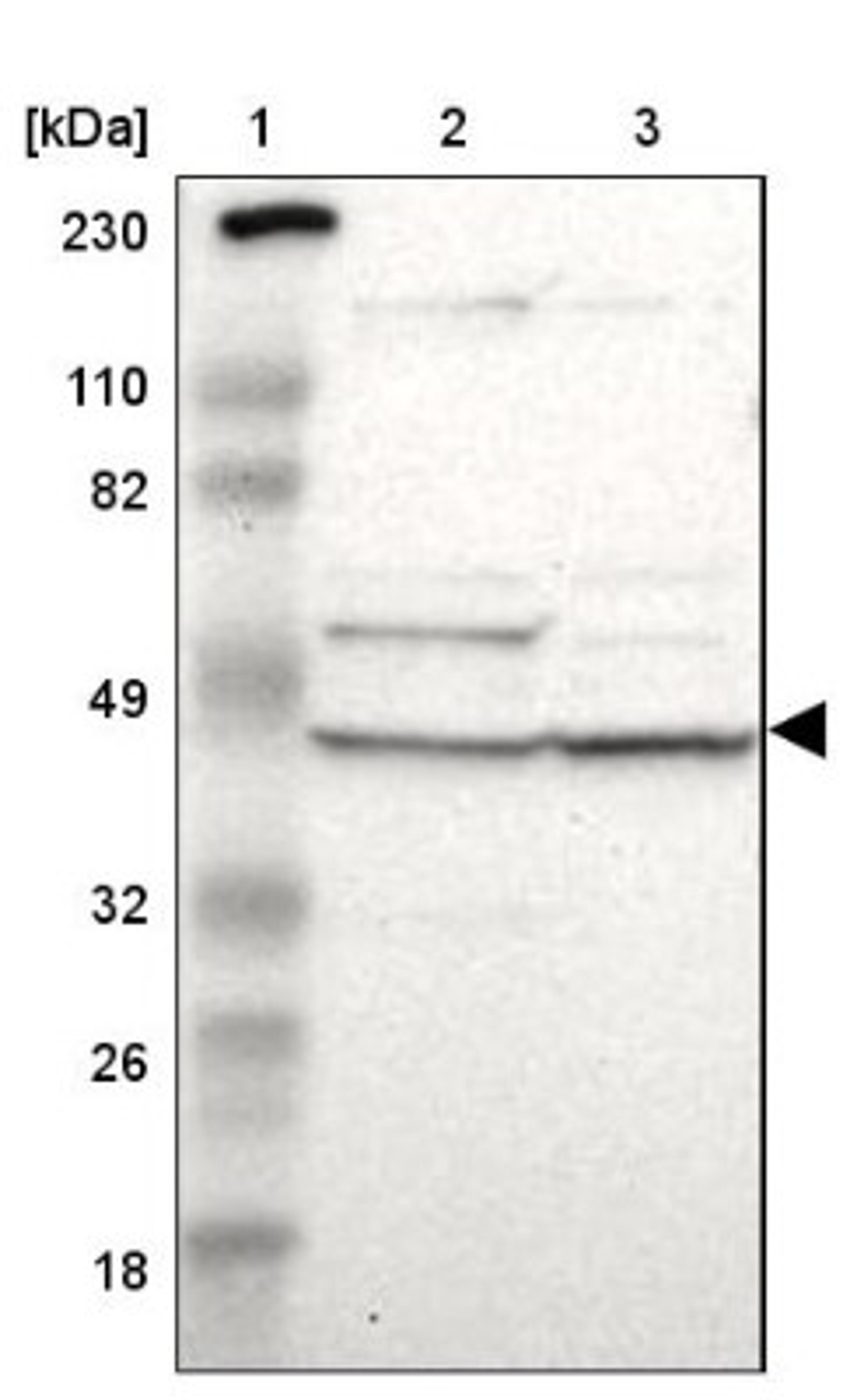 Western Blot: VSIG4 Antibody [NBP1-86843] - Lane 1: Marker [kDa] 230, 110, 82, 49, 32, 26, 18<br/>Lane 2: Human cell line RT-4<br/>Lane 3: Human cell line U-251MG sp