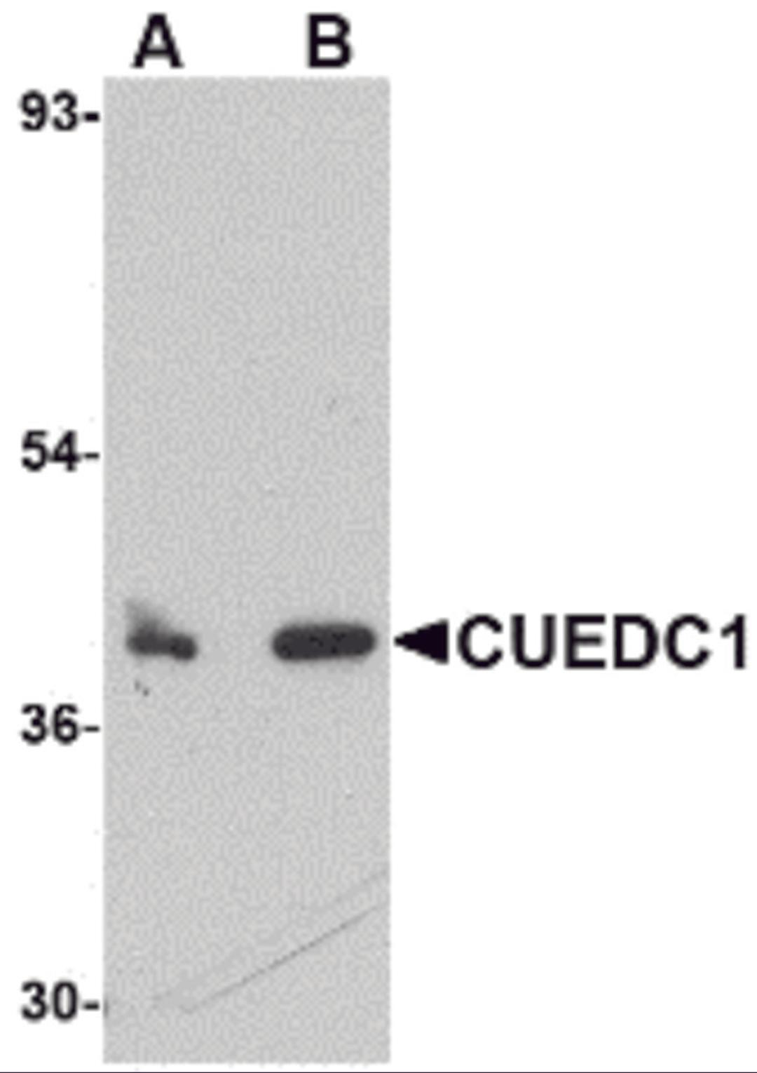 Western blot analysis of CUEDC1 in rat liver tissue lysate with CUEDC1 antibody at (A) 0.5 and (B) 1 μg/mL.