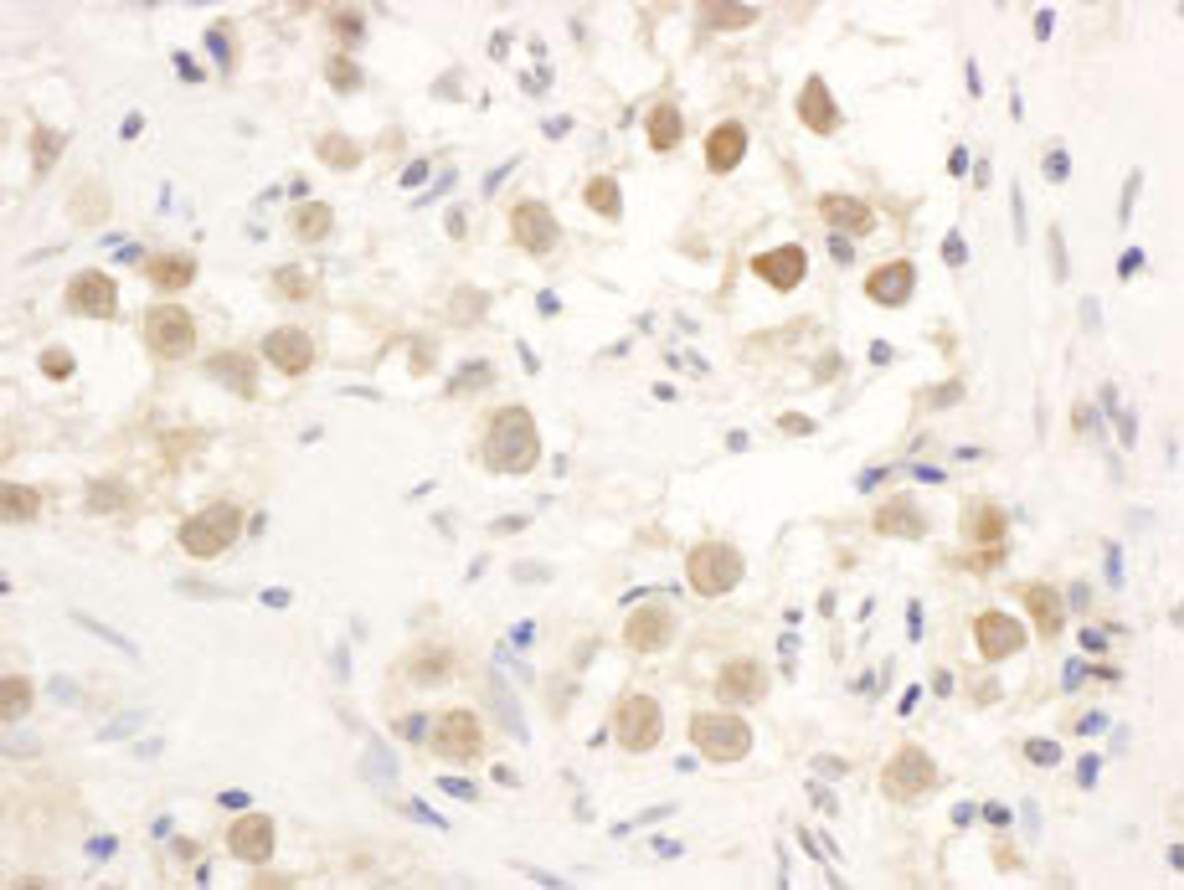 Detection of human CHK1 by immunohistochemistry.