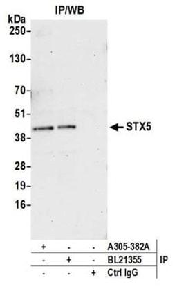 Detection of human STX5 by western blot of immunoprecipitates.