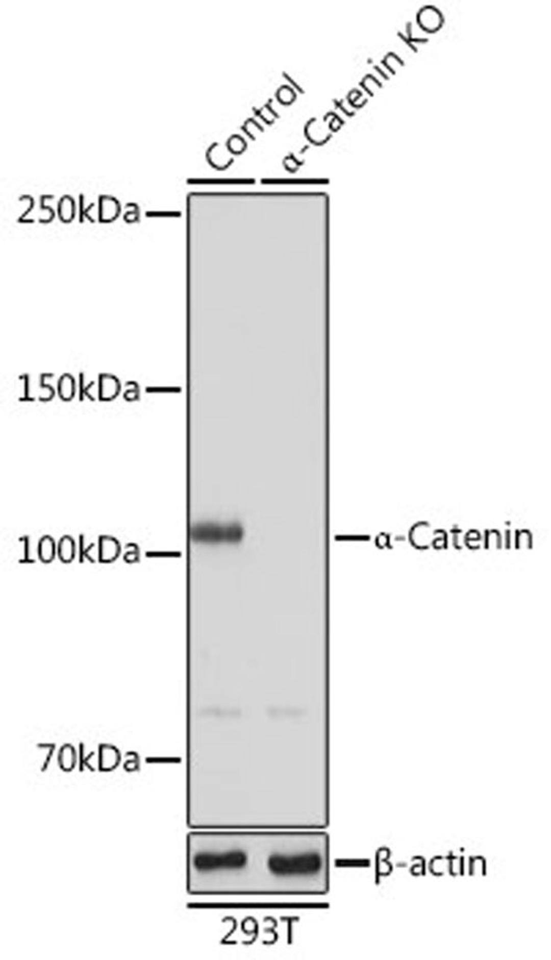 Western blot - a-Catenin antibody (A19004)