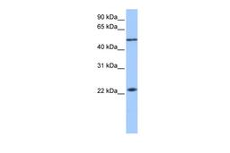 Antibody used in WB on Human Liver at 0.2-1 ug/ml.