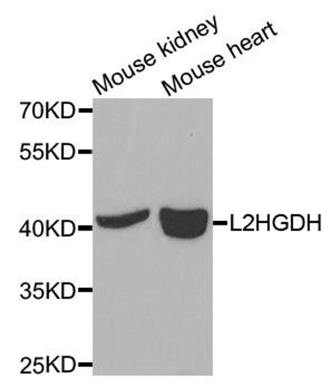 Western blot analysis of extracts of various cells using L2HGDH antibody