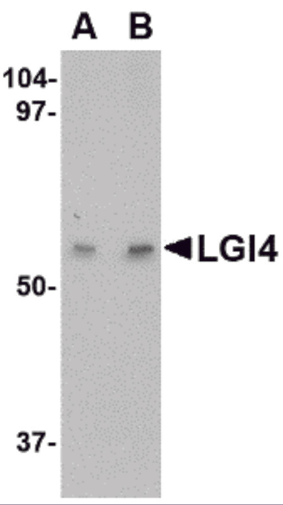 Western blot analysis of LGI4 in human brain tissue lysate with LGI4 antibody at (A) 1 and (B) 2 μg/mL.
