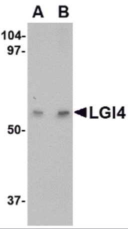 Western blot analysis of LGI4 in human brain tissue lysate with LGI4 antibody at (A) 1 and (B) 2 μg/mL.