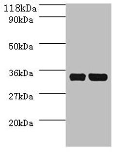 Western blot. All lanes: dcyD antibody at 2ug/ml + DH5a whole cell lysate. Secondary. Goat polyclonal to rabbit IgG at 1/10000 dilution. Predicted band size: 35 kDa. Observed band size: 35 kDa. 