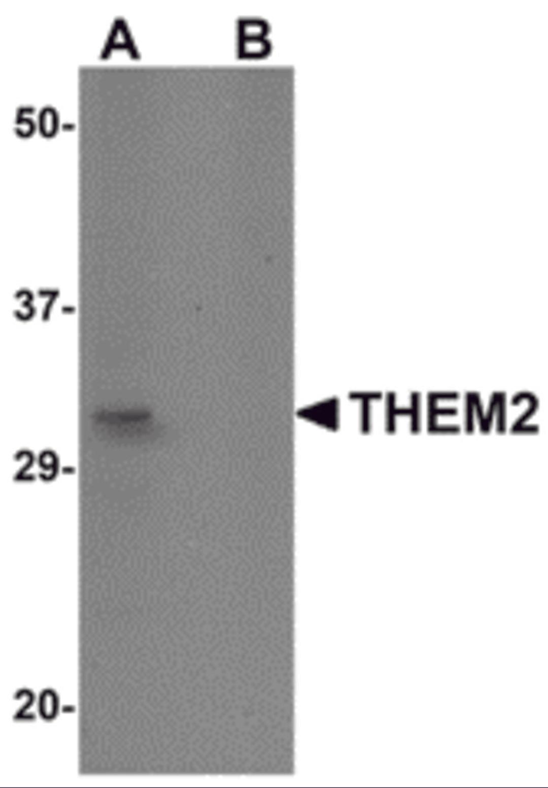 Western blot analysis of THEM2 in HepG2 cell lysate with THEM2 antibody at 1 &#956;g/mL in (A) the absence and (B) the presence of blocking peptide.