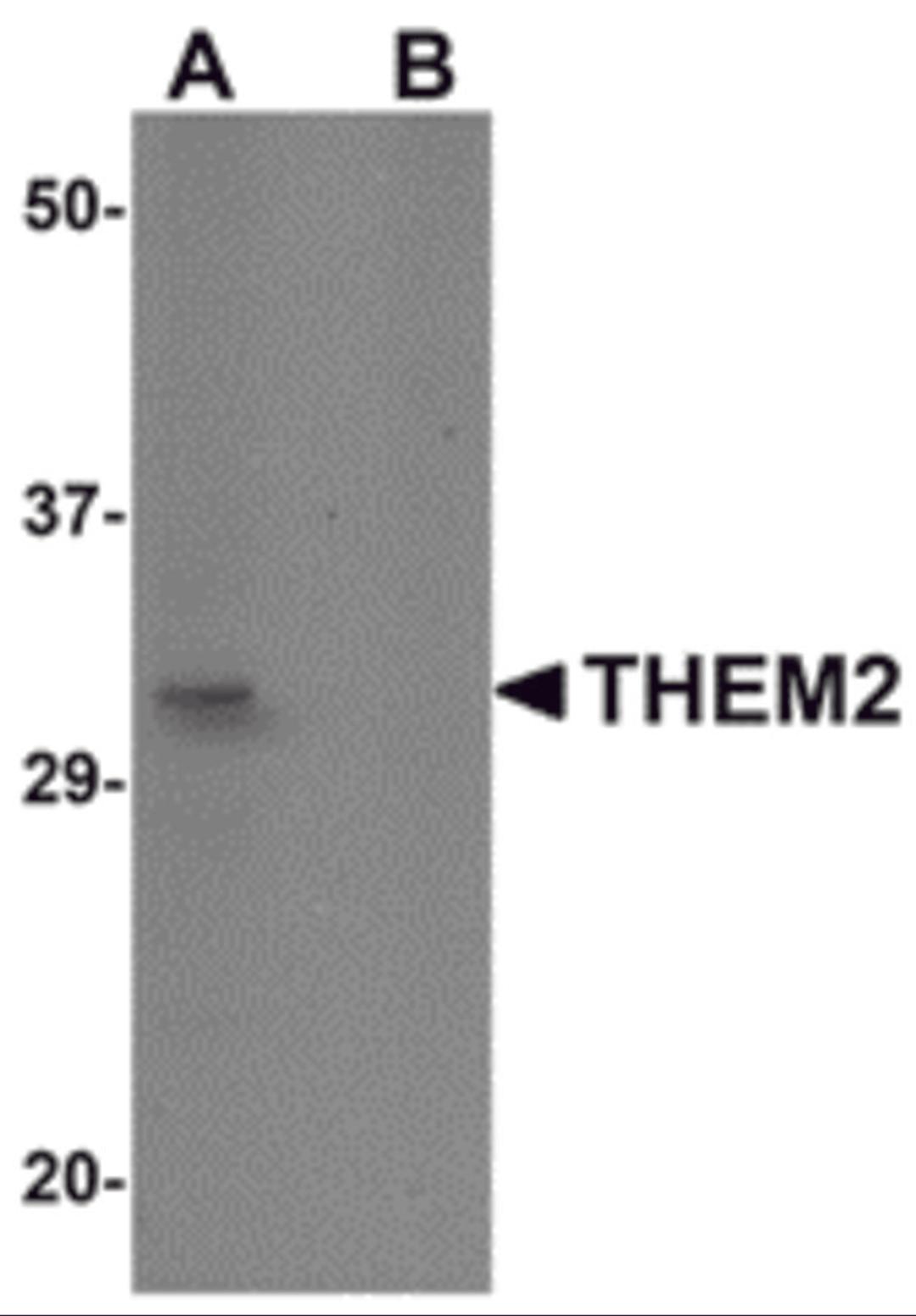 Western blot analysis of THEM2 in HepG2 cell lysate with THEM2 antibody at 1 μg/mL in (A) the absence and (B) the presence of blocking peptide.