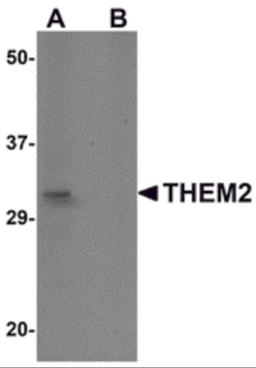 Western blot analysis of THEM2 in HepG2 cell lysate with THEM2 antibody at 1 μg/mL in (A) the absence and (B) the presence of blocking peptide.