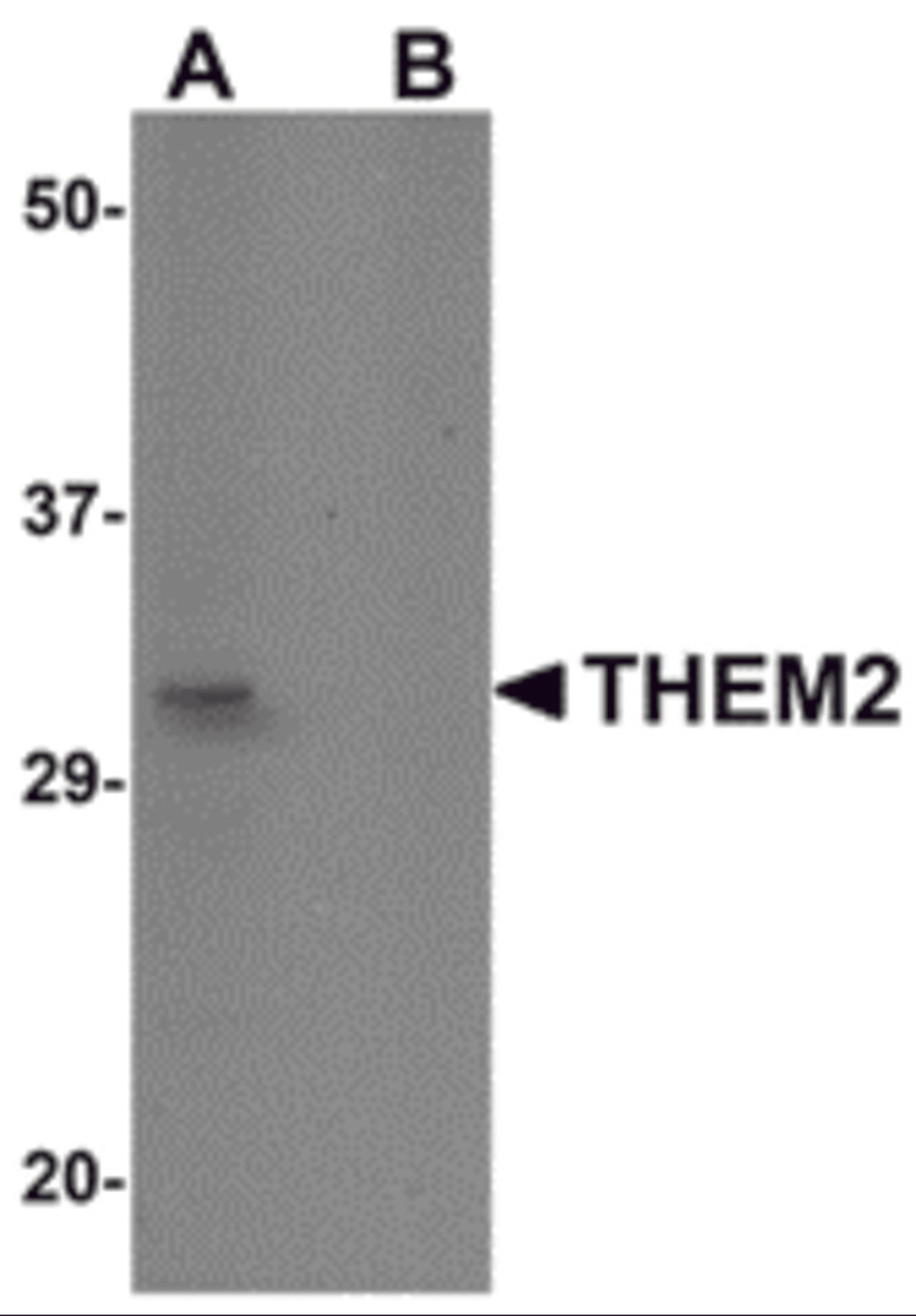Western blot analysis of THEM2 in HepG2 cell lysate with THEM2 antibody at 1 μg/mL in (A) the absence and (B) the presence of blocking peptide.