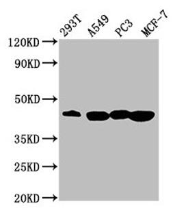 Western Blot. Positive WB detected in: 293T whole cell lysate, A549 whole cell lysate, PC-3 whole cell lysate, MCF-7 whole cell lysate. All lanes: SAV1 antibody at 3.64µg/ml. Secondary. Goat polyclonal to rabbit IgG at 1/50000 dilution. Predicted band size: 45 kDa. Observed band size: 45 kDa