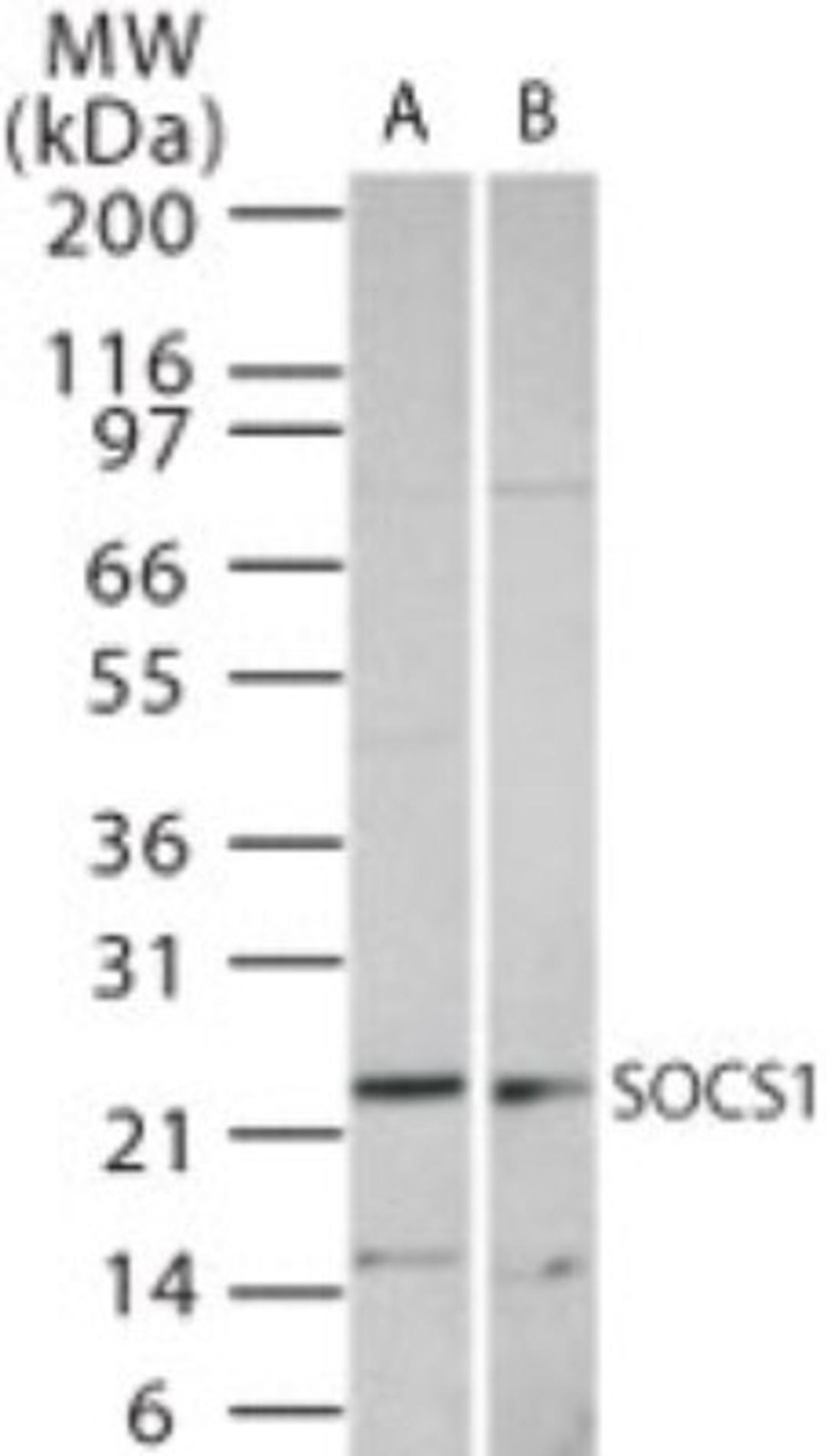 Western Blot: SOCS1 Antibody [NB100-56637] - Western blot analysis of SOCS1 using NB100-56637 at 1:1000 dilution against 15 ug/lane of Ramos (A) and Raw (B) cell lysate.