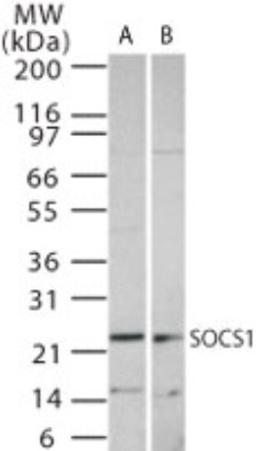 Western Blot: SOCS1 Antibody [NB100-56637] - Western blot analysis of SOCS1 using NB100-56637 at 1:1000 dilution against 15 ug/lane of Ramos (A) and Raw (B) cell lysate.