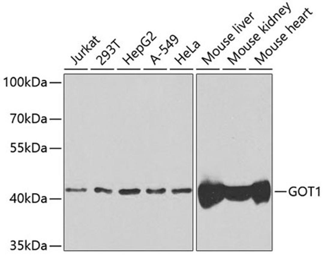 Western blot - GOT1 antibody (A5822)