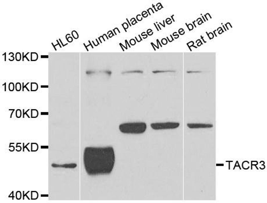 Western blot analysis of extracts of various cell lines using TACR3 antibody