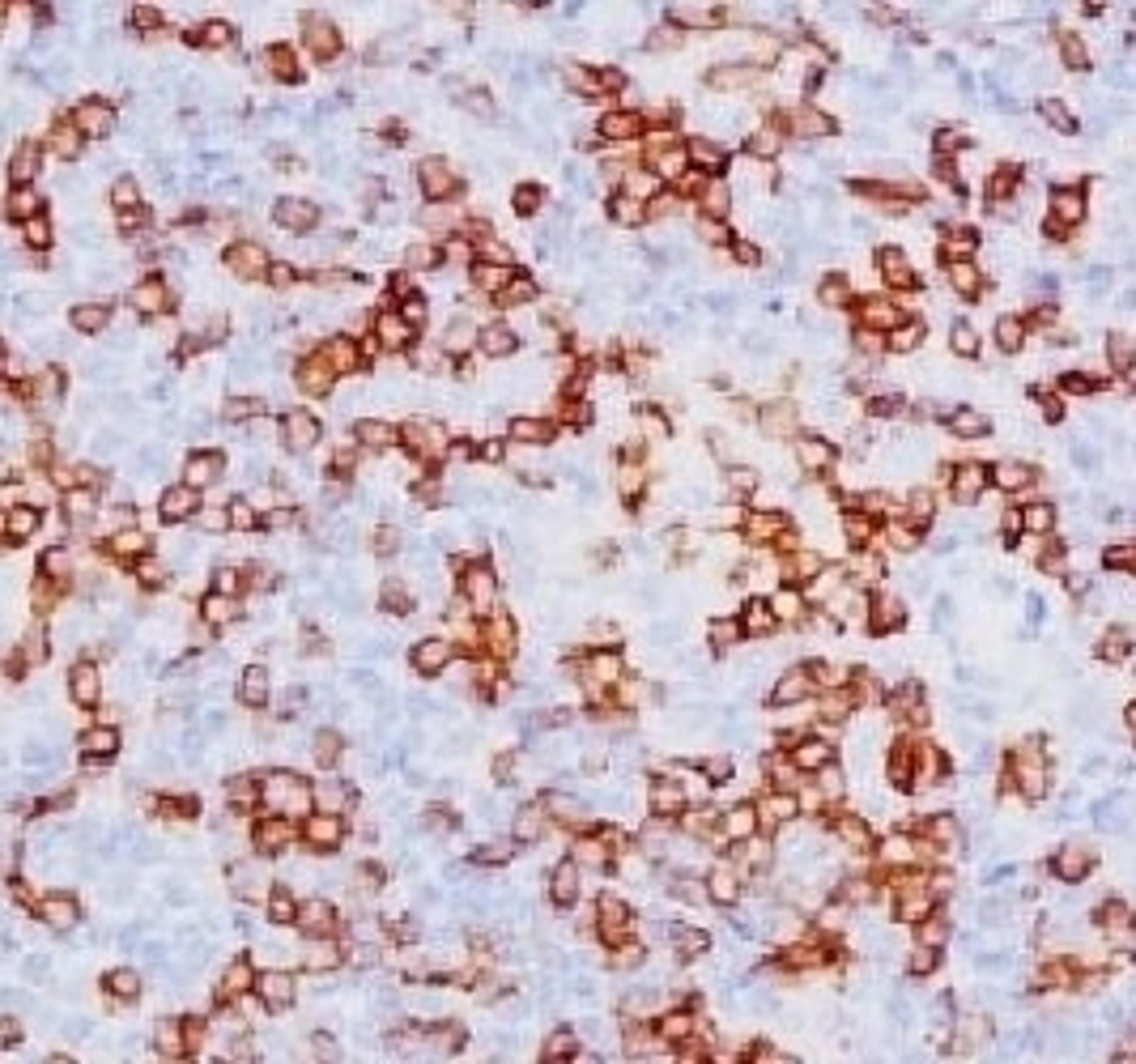 IHC testing of CD8a antibody and human tonsil