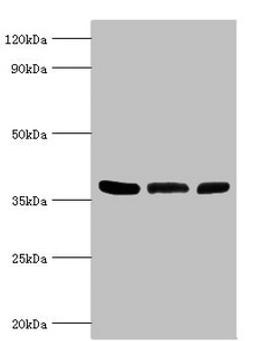 Western blot. All lanes: ARG2 antibody at 5µg/ml. Lane 1: Mouse liver tissue. Lane 2: 293T whole cell lysate. Lane 3: Mouse kidney tissue. Secondary. Goat polyclonal to rabbit IgG at 1/10000 dilution. Predicted band size: 39 kDa. Observed band size: 39 kDa