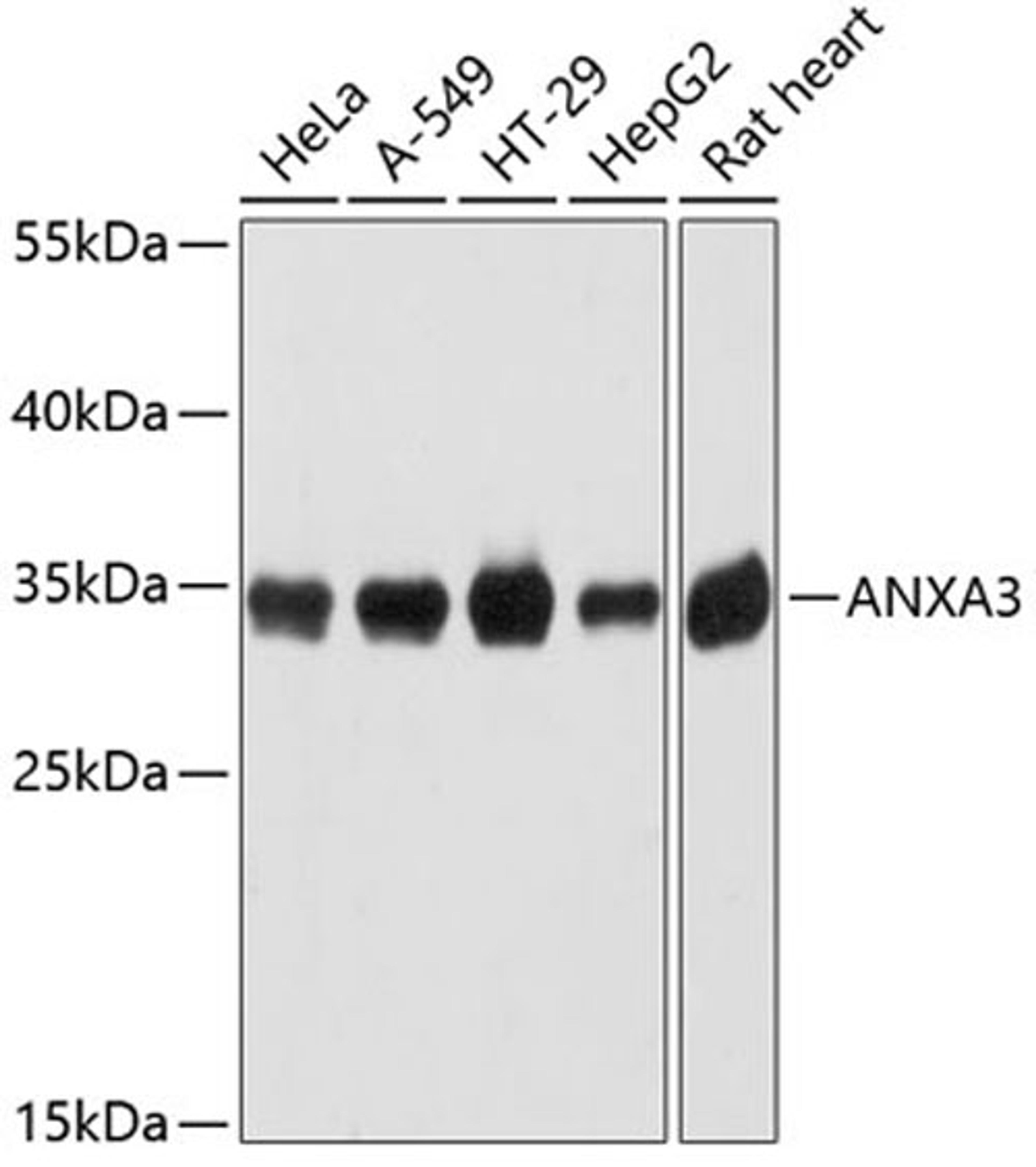 Western blot - ANXA3 antibody (A12379)