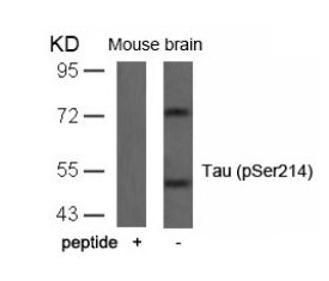 Western blot analysis of lysed extracts from mouse brain tissue using Tau (Phospho-Ser214).