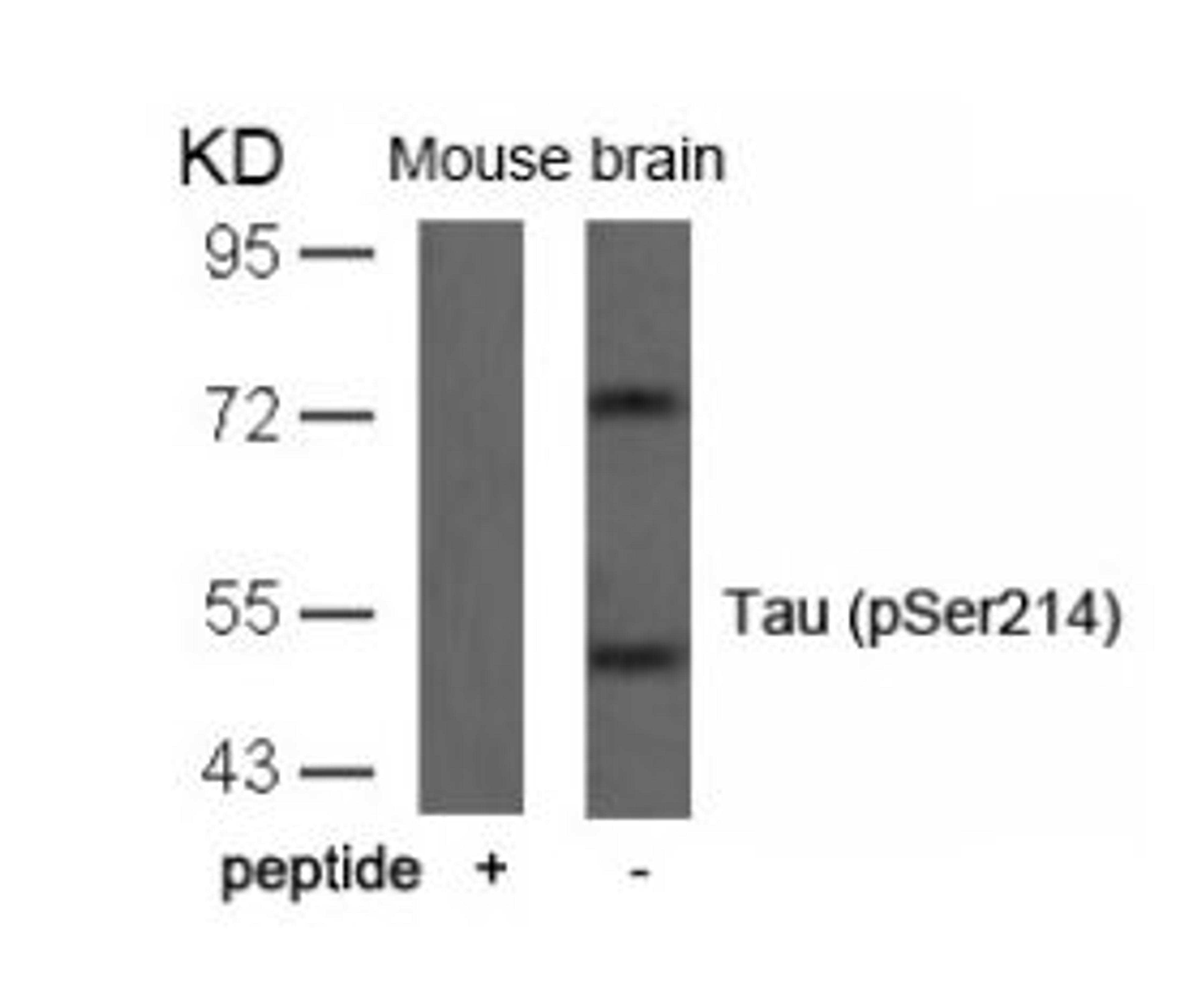 Western blot analysis of lysed extracts from mouse brain tissue using Tau (Phospho-Ser214).