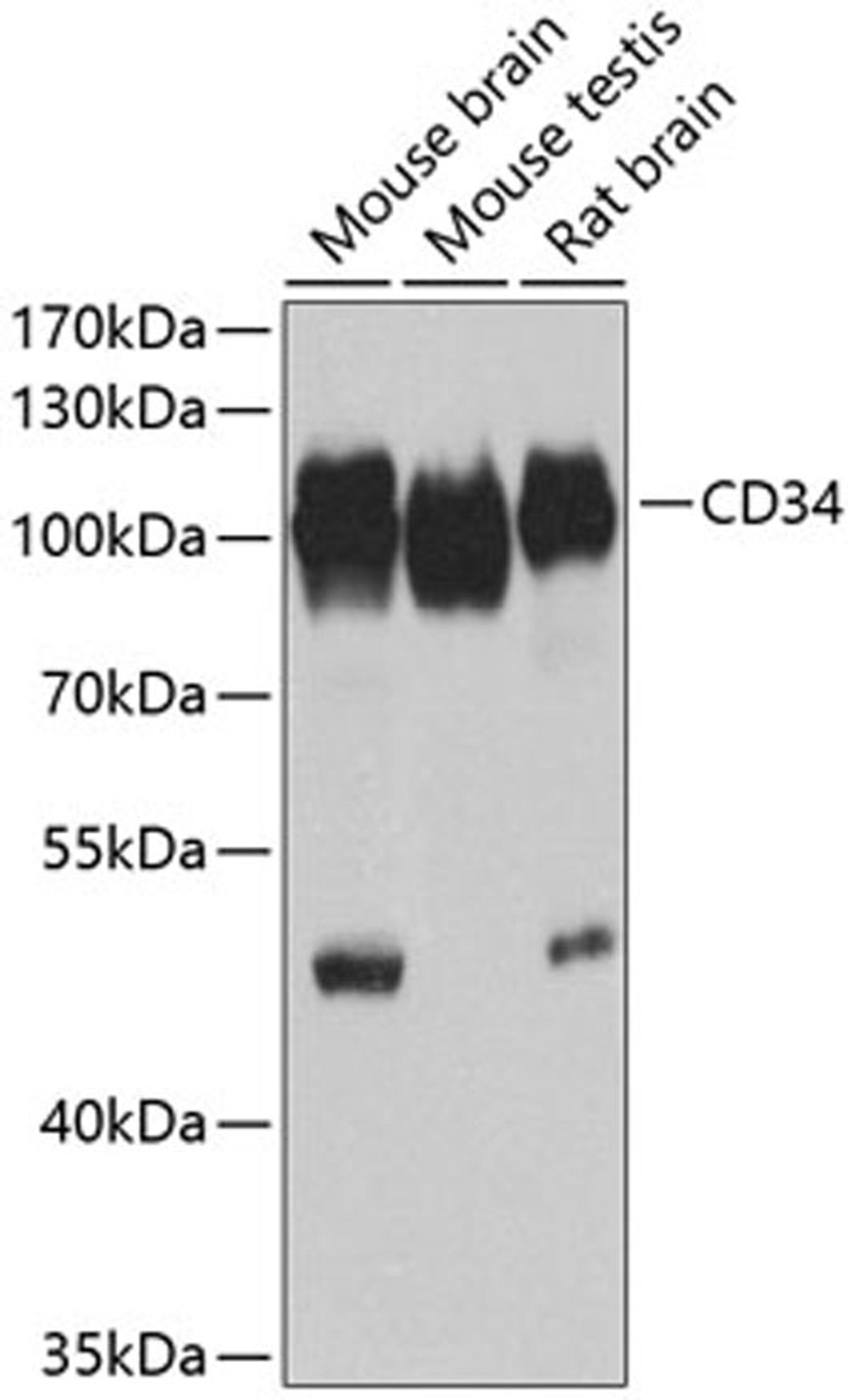 Western blot - CD34 Antibody (A13929)