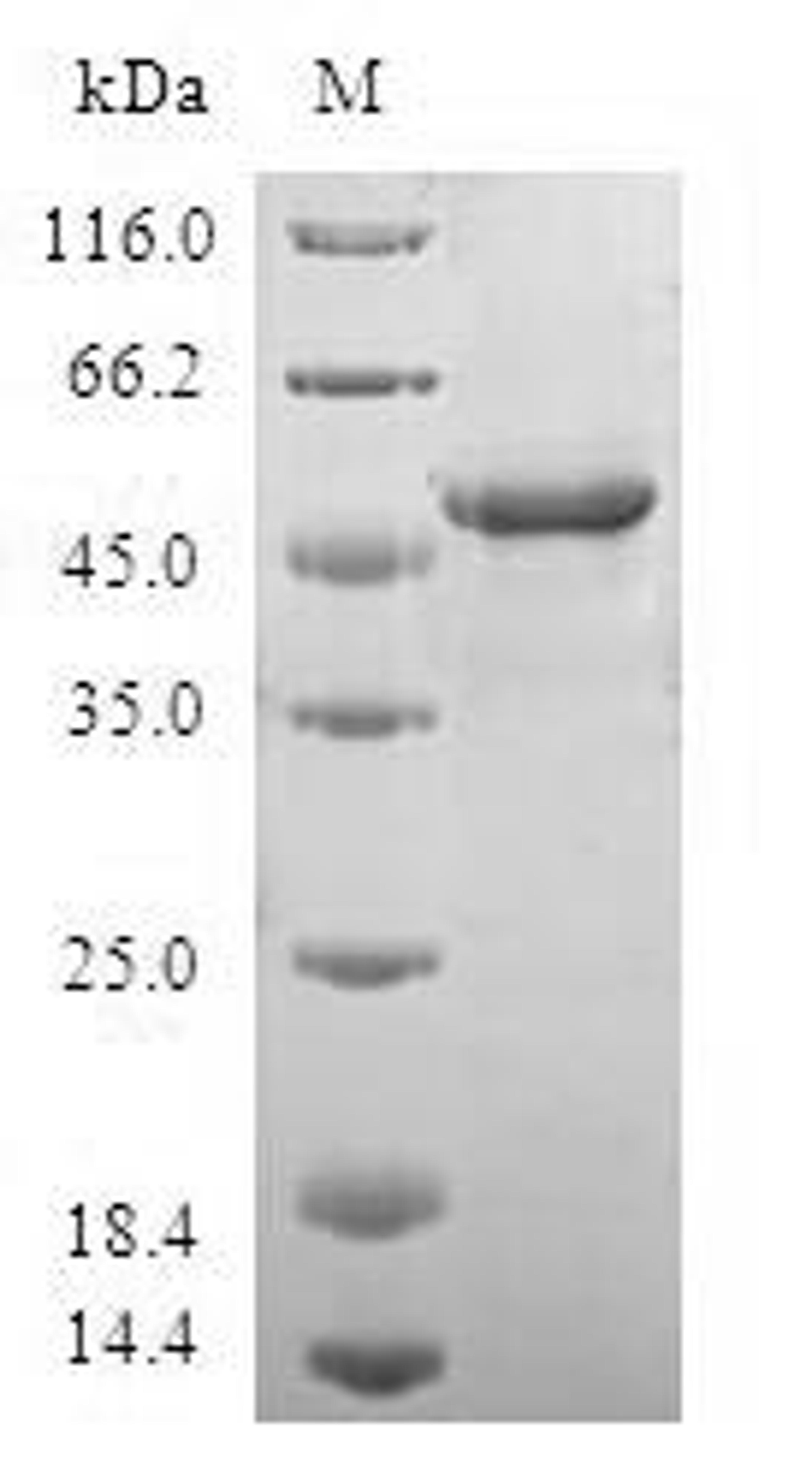 (Tris-Glycine gel) Discontinuous SDS-PAGE (reduced) with 5% enrichment gel and 15% separation gel.