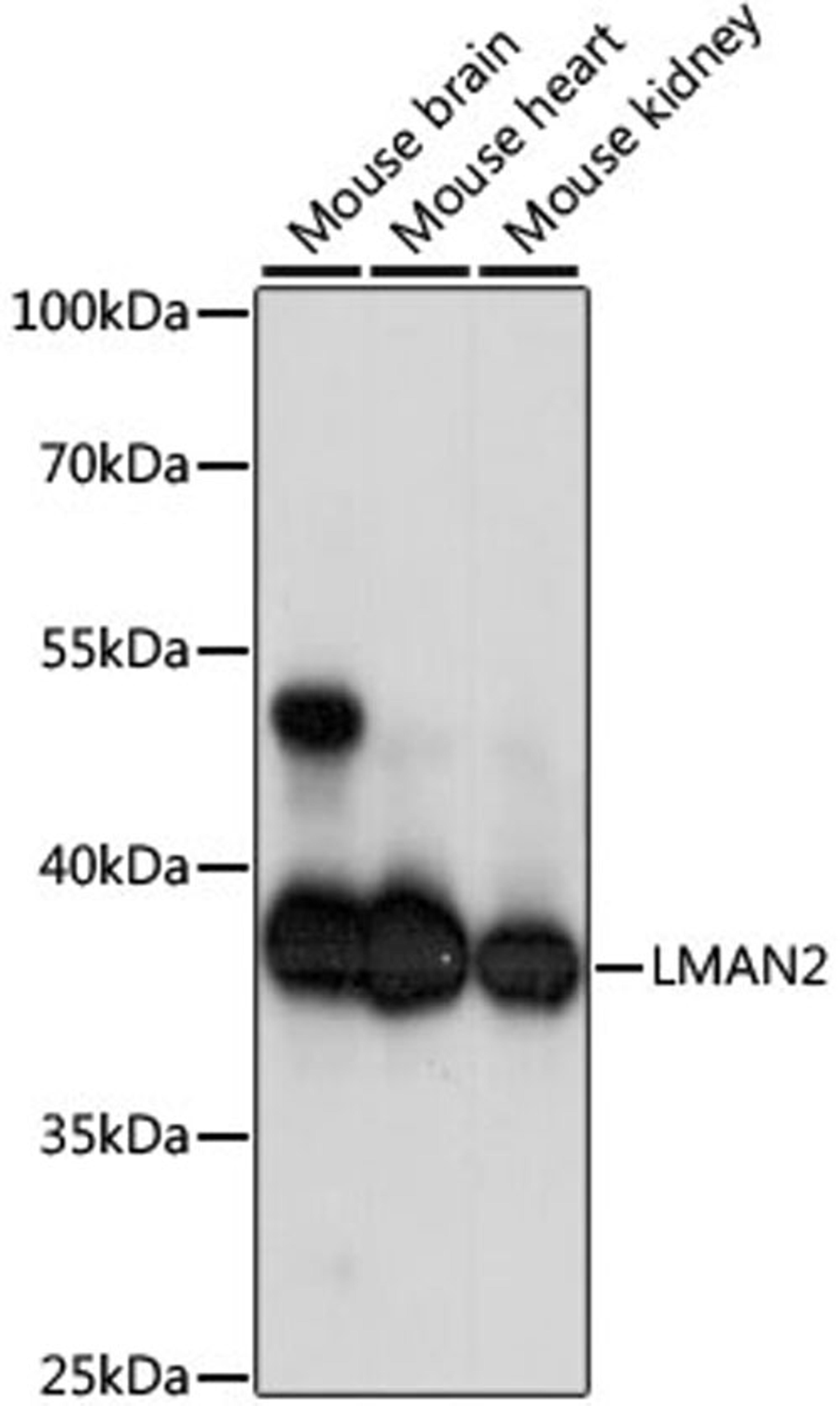 Western blot - LMAN2 antibody (A15394)