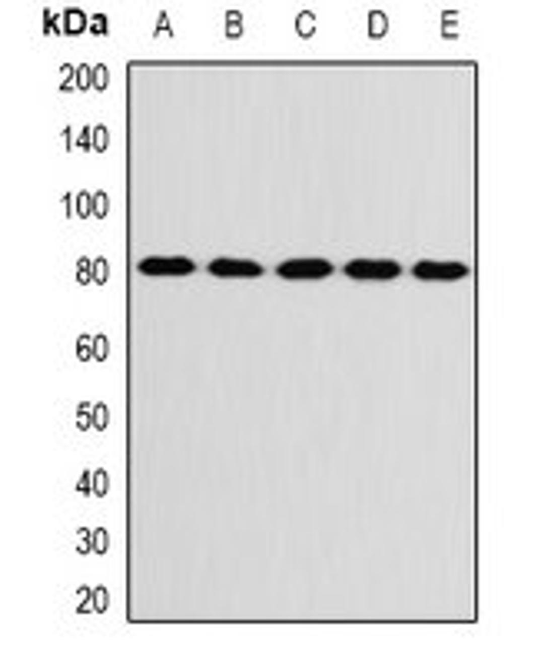 Western blot analysis of SW480 (Lane1), SKOV3 (Lane2), mouse brain (Lane3), mouse ovary (Lane4), rat liver (Lane5) whole cell lysates using KIF3A antibody