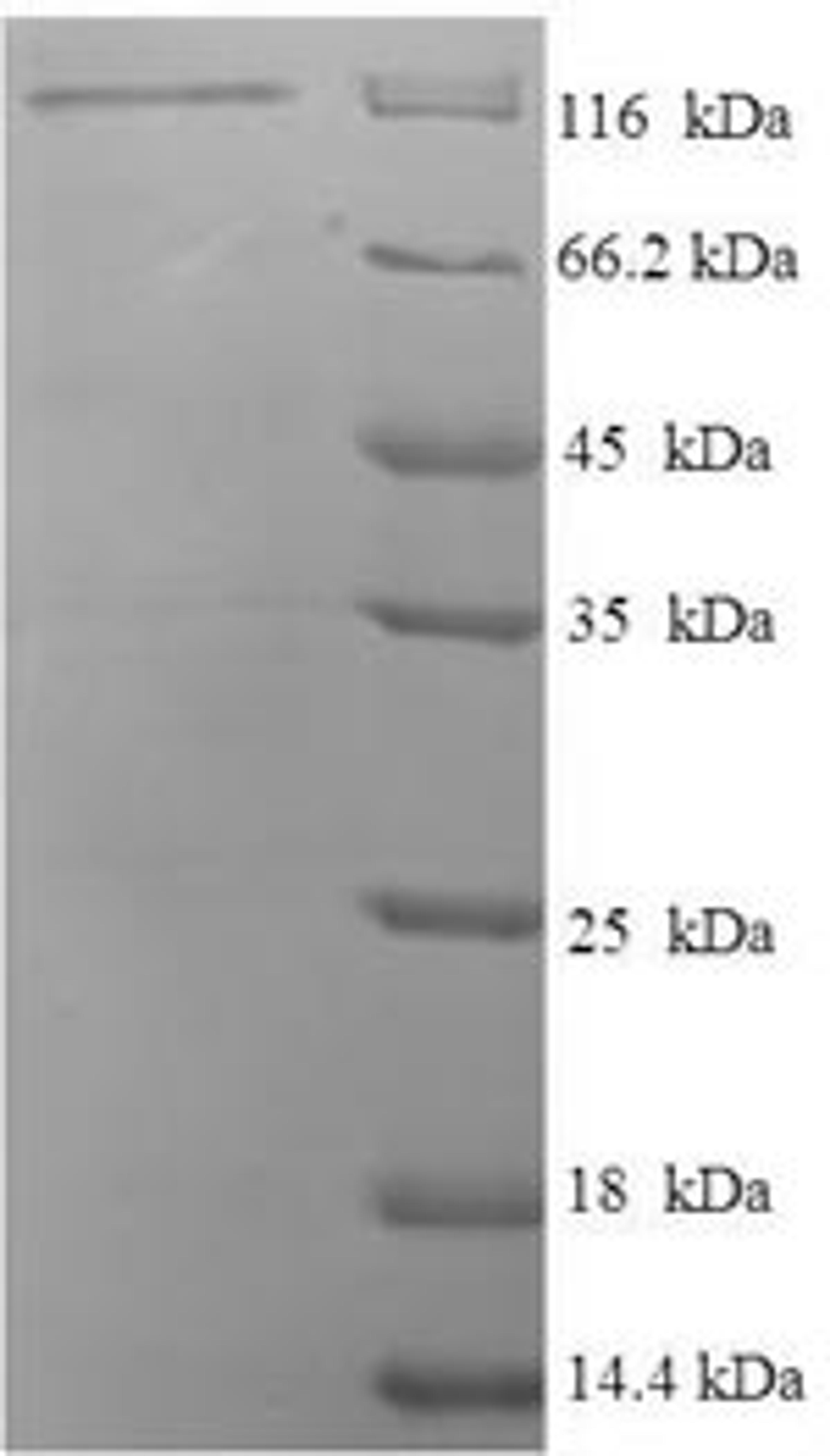 (Tris-Glycine gel) Discontinuous SDS-PAGE (reduced) with 5% enrichment gel and 15% separation gel.
