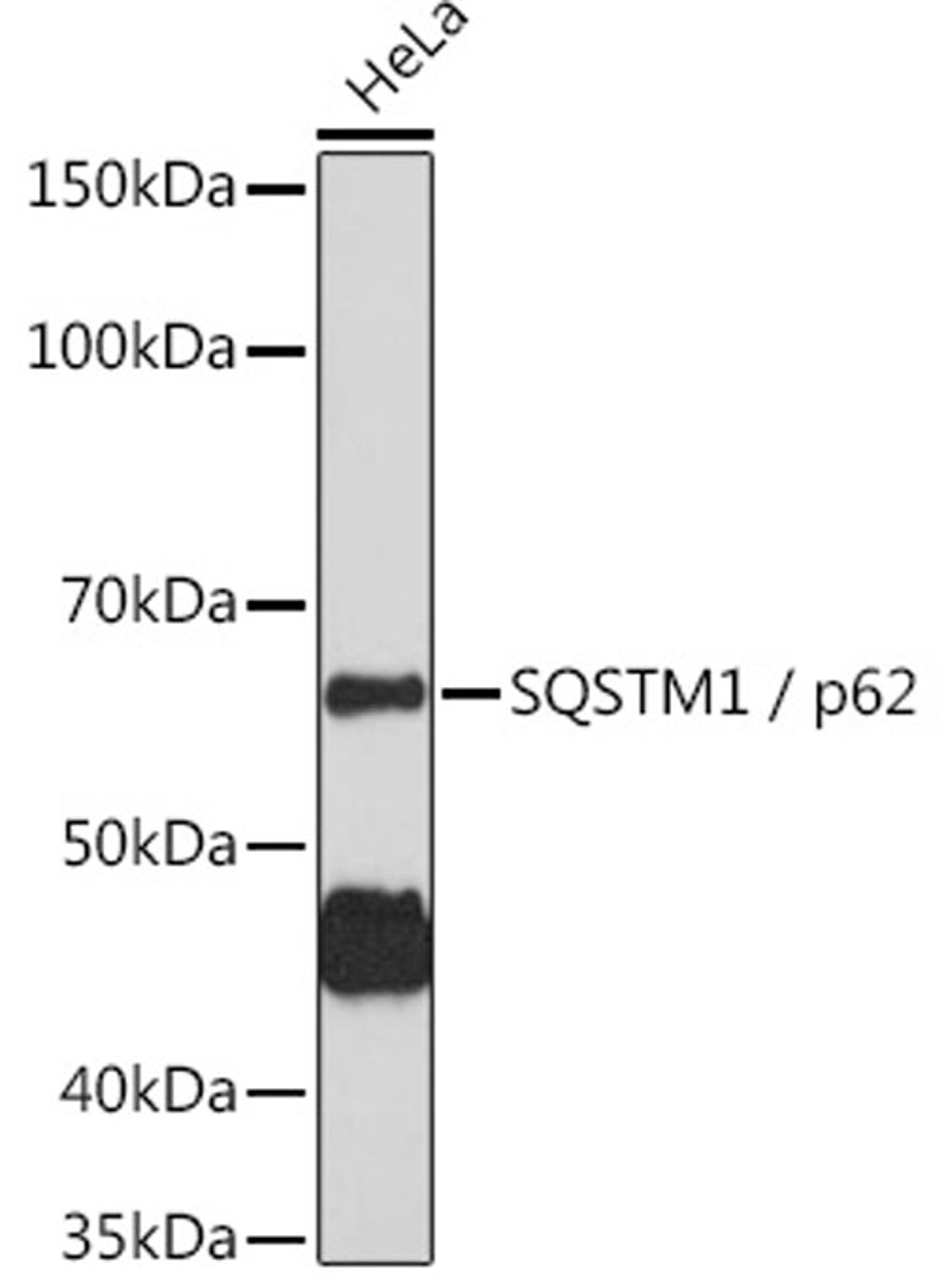 Western blot - SQSTM1 / p62 antibody (A11247)