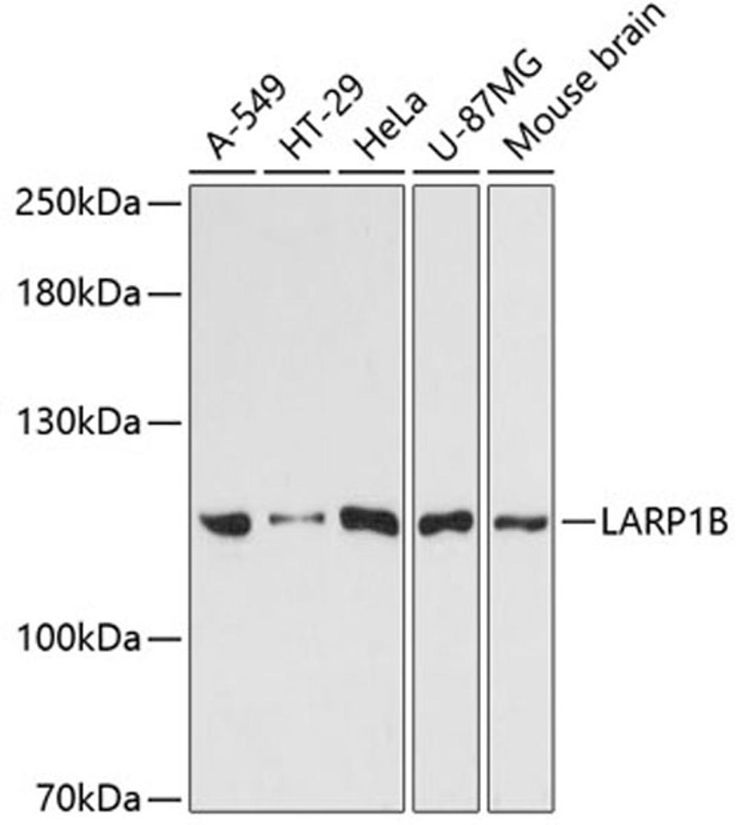 Western blot - LARP1B antibody (A13222)