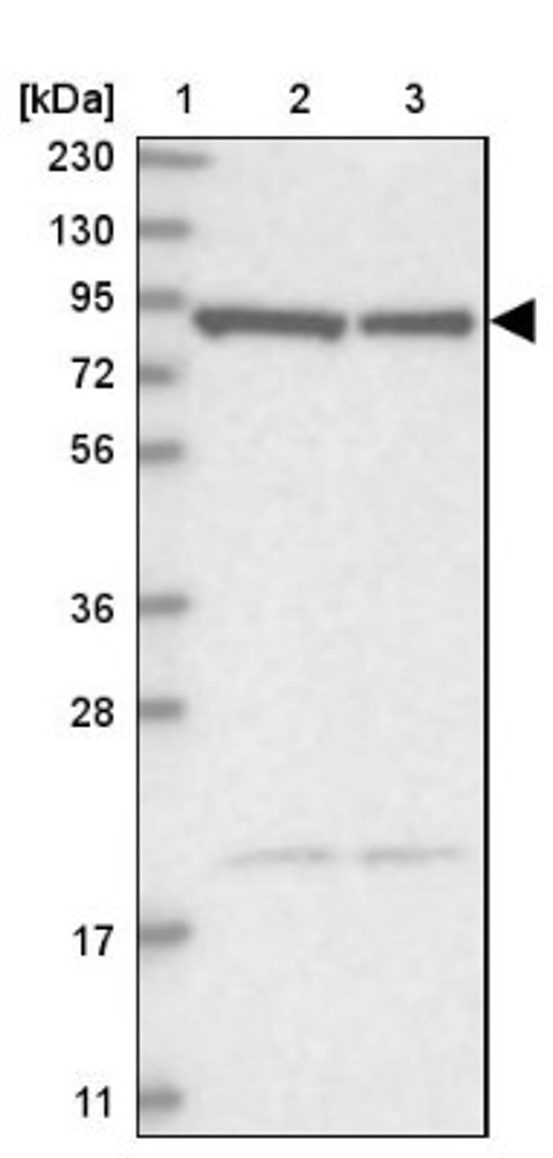 Western Blot: CHML Antibody [NBP1-87142] - Lane 1: Marker [kDa] 230, 130, 95, 72, 56, 36, 28, 17, 11<br/>Lane 2: Human cell line RT-4<br/>Lane 3: Human cell line U-251MG sp