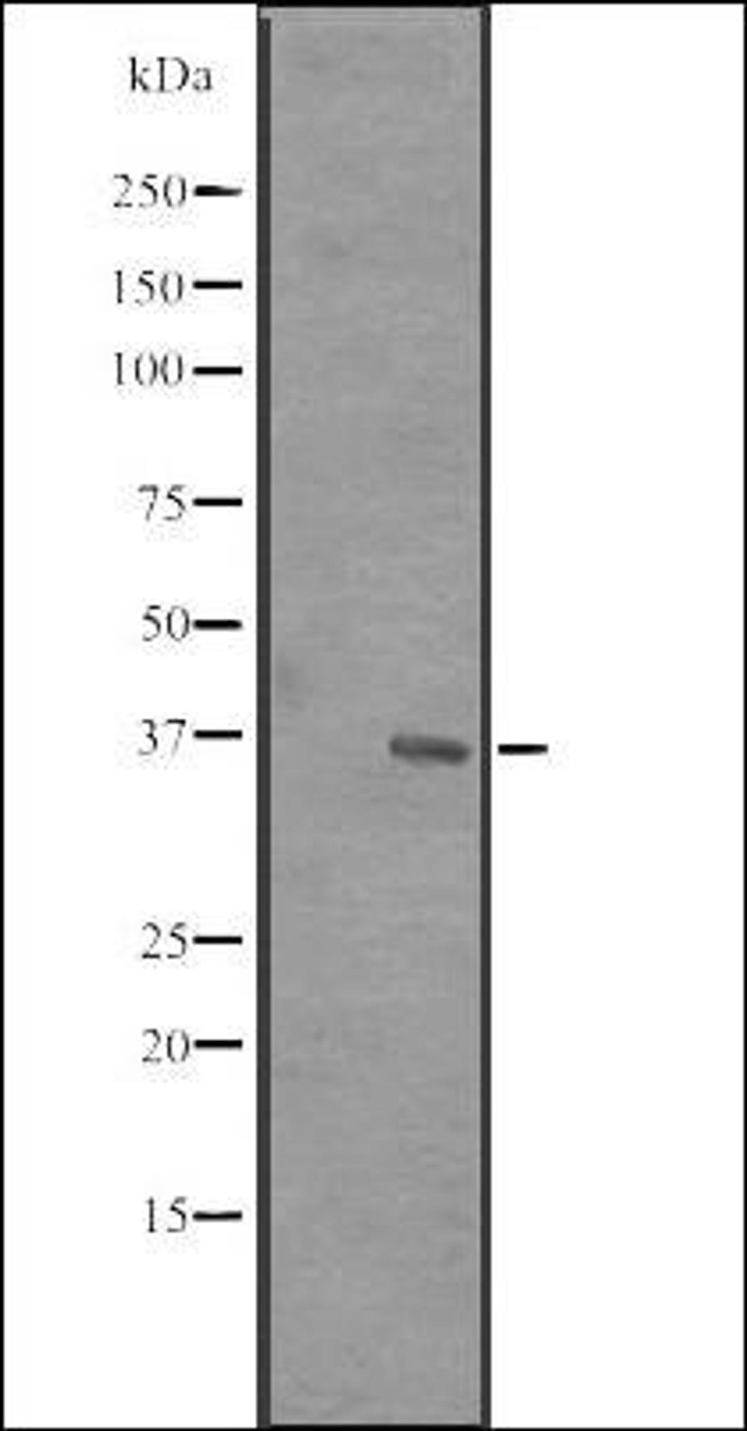 Western blot analysis of MCF7 cell lysate using RRP7 antibody