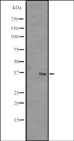 Western blot analysis of MCF7 cell lysate using RRP7 antibody