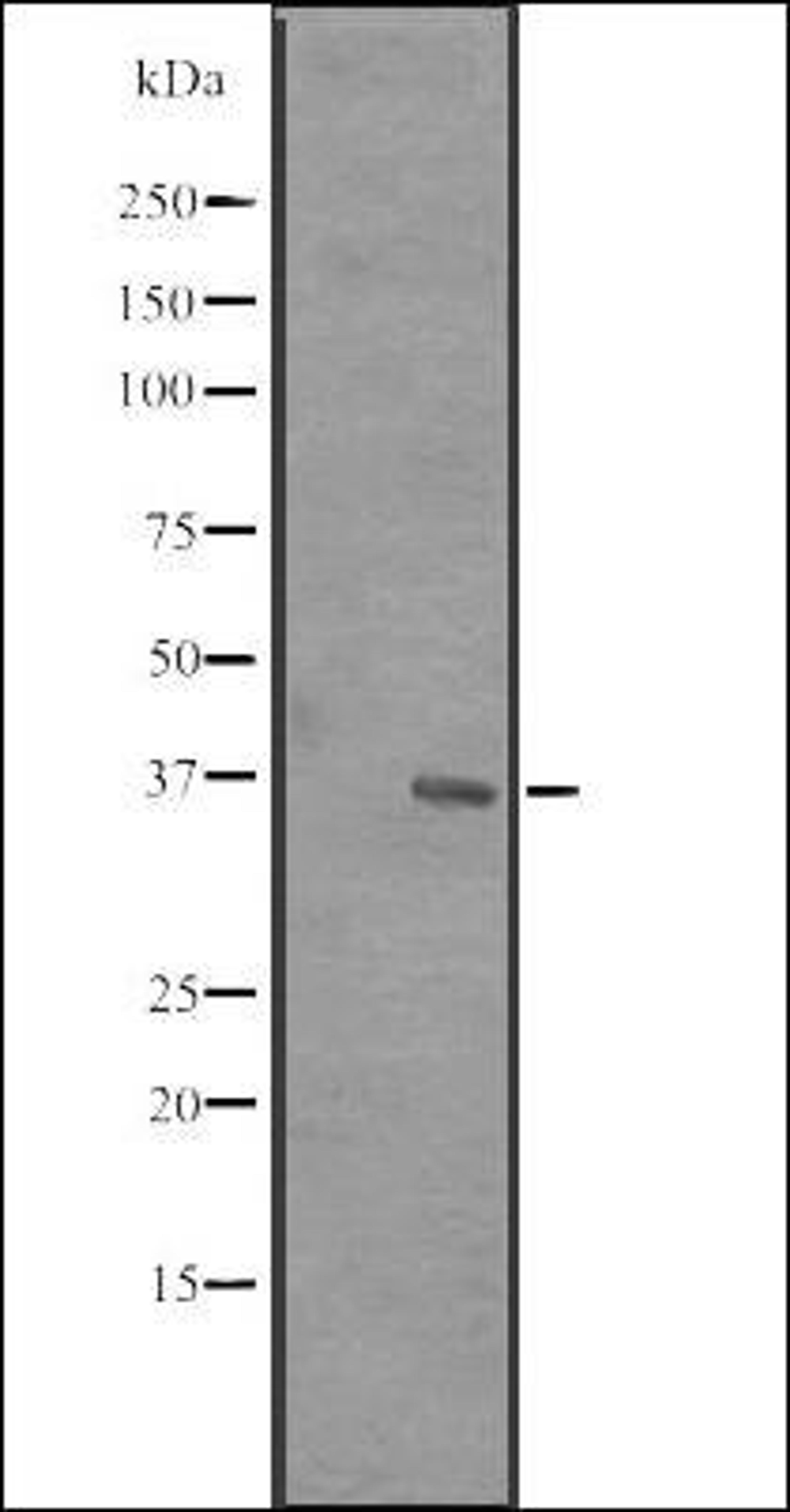 Western blot analysis of MCF7 cell lysate using RRP7 antibody