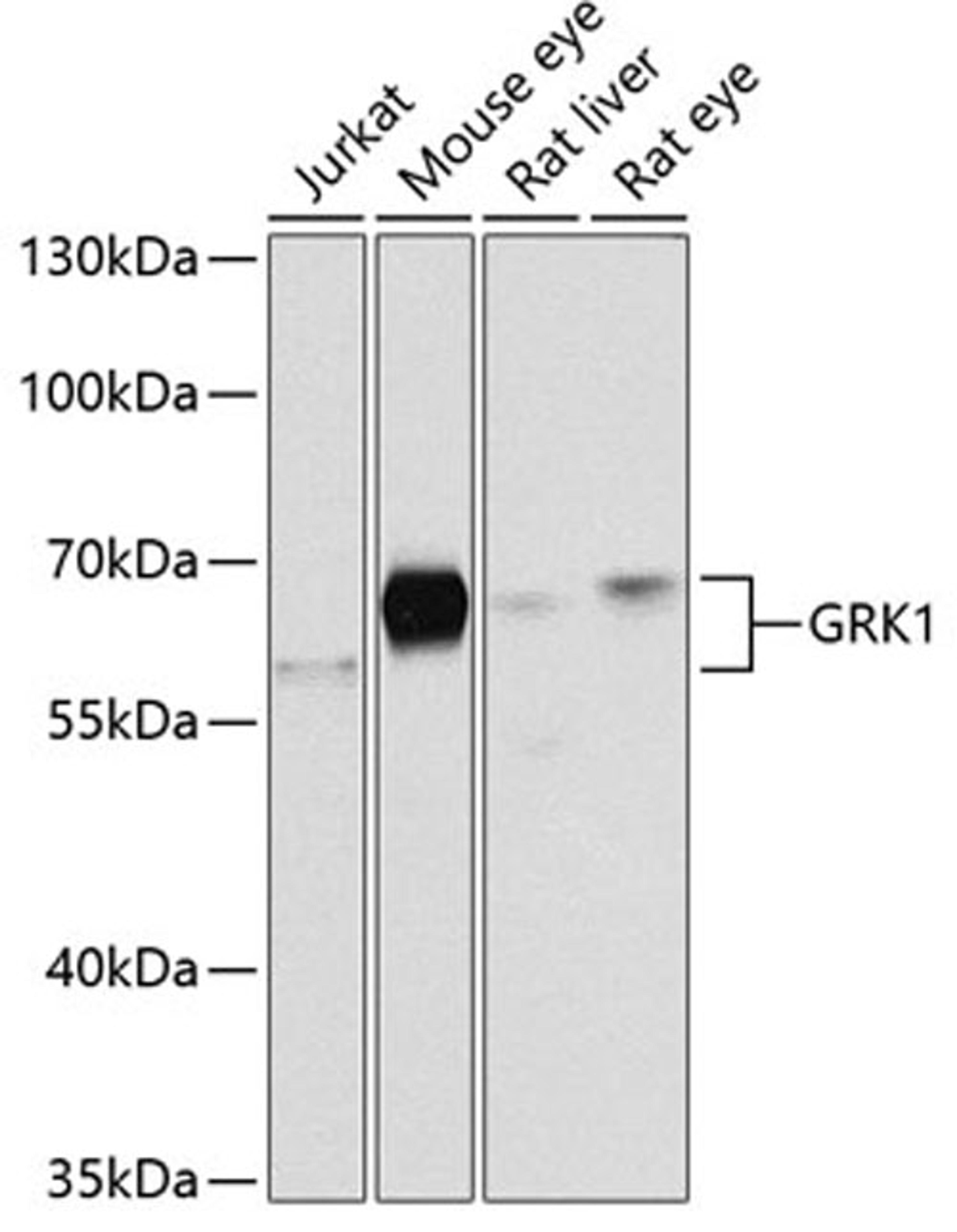 Western blot - GRK1 antibody (A2966)