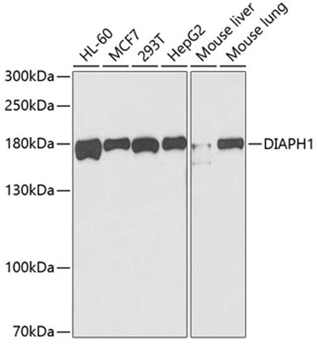 Western blot - DIAPH1 antibody (A5772)