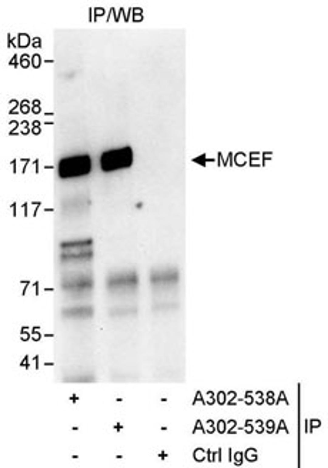 Detection of human MCEF by western blot of immunoprecipitates.