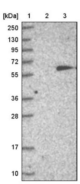 Western Blot: MTAC2D1 Antibody [NBP1-89900] - Lane 1: Marker [kDa] 250, 130, 95, 72, 55, 36, 28, 17, 10<br/>Lane 2: Negative control (vector only transfected HEK293T lysate)<br/>Lane 3: Over-expression lysate (Co-expressed with a C-terminal myc-DDK tag (~3.1 kDa) in mammalian HEK293T cells, LY403463)